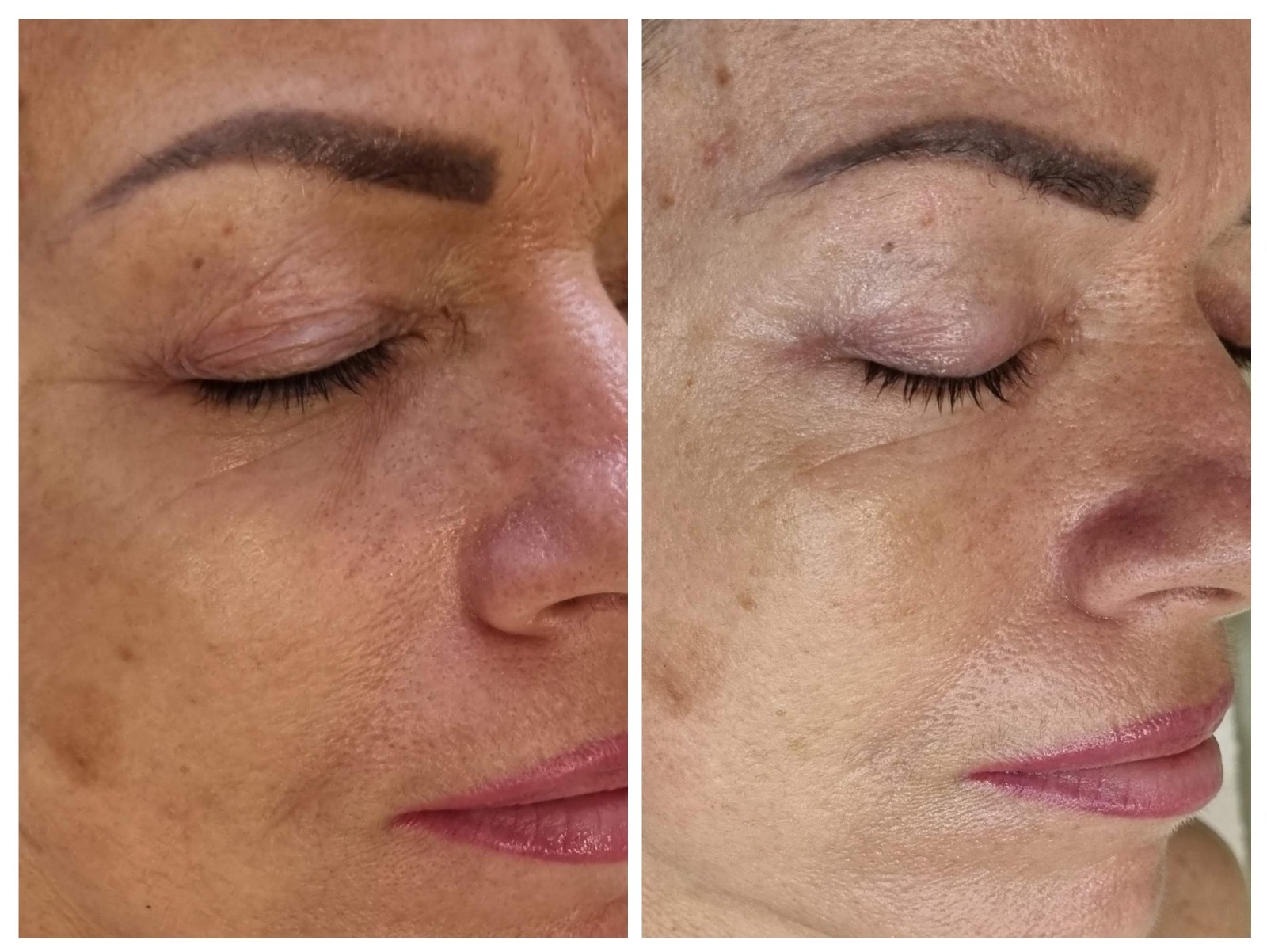 Műszempilla töltés – referencia munka